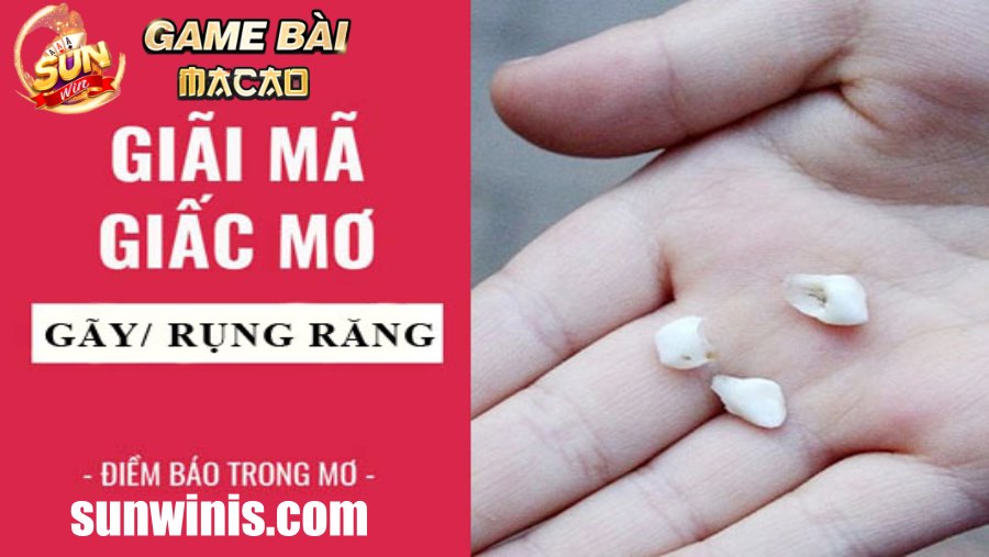 Giải mã chi tiết giấc mơ rụng răng